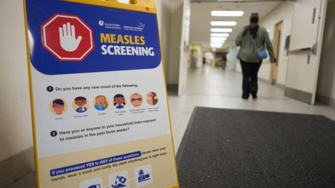 Canada fought measles and measles won; virus now endemic after 1998 elimination Canada fought measles and measles won; virus now endemic after 1998 elimination